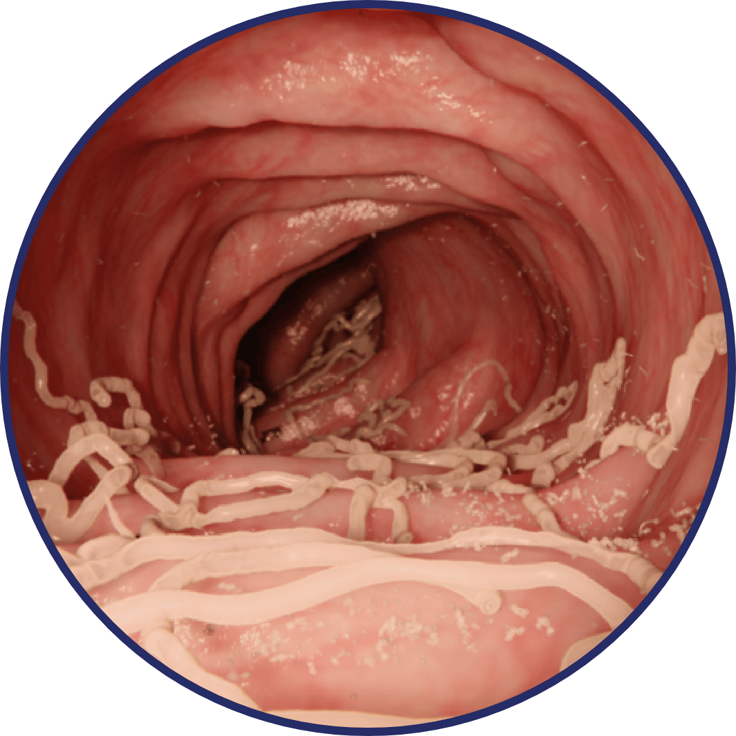 Roundworms